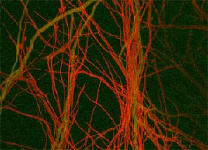 Trichoderma atroviride